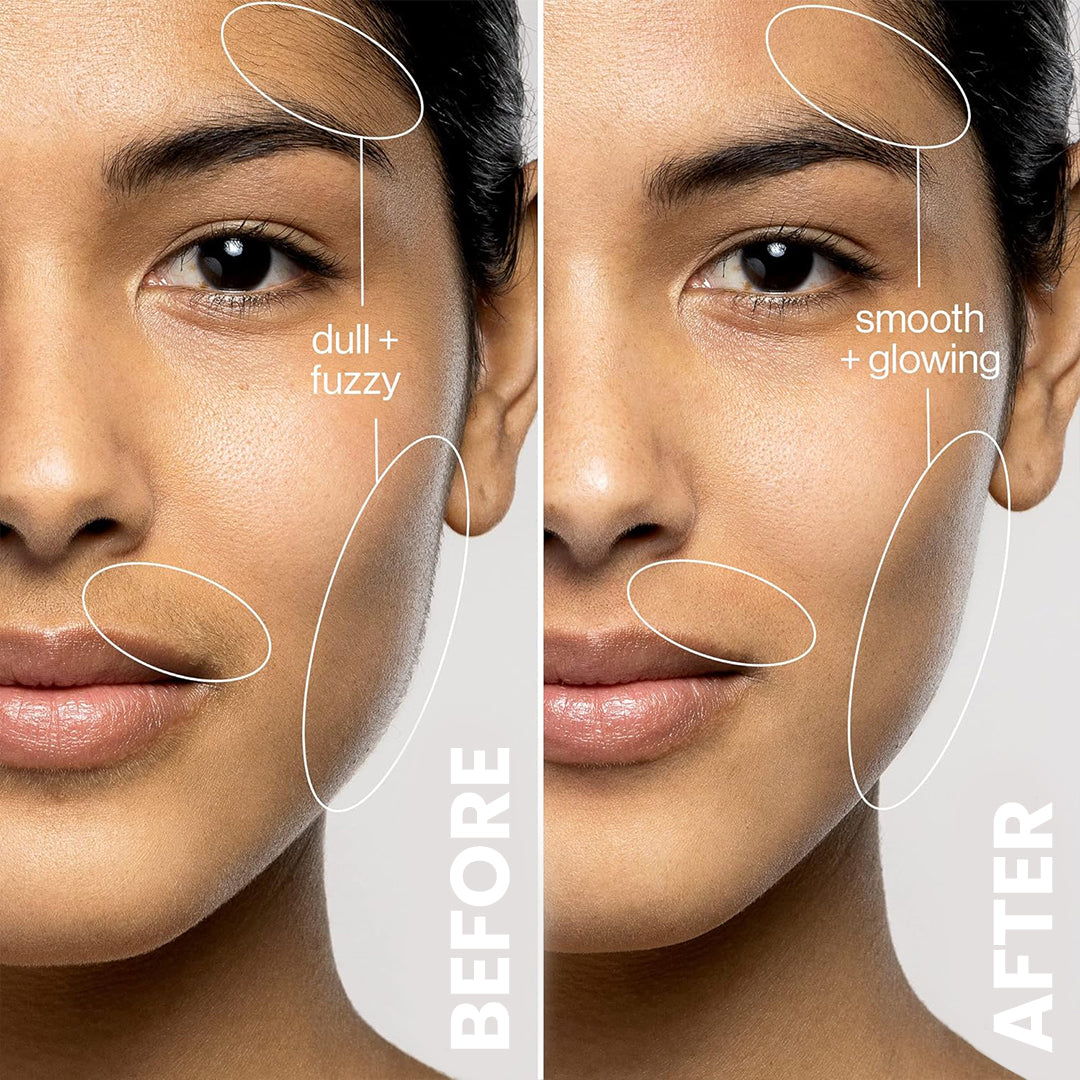 5MINSKIN ELECTRIC DERMAPLANING TOOL - 50% OFF HALLOWEEN SALE + 3 FREE GIFTS (WORTH $112)