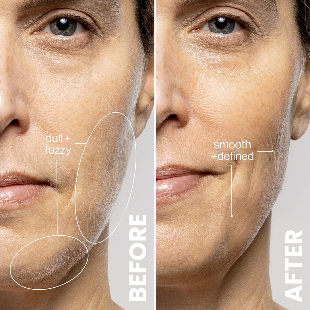 5MINSKIN ELECTRIC DERMAPLANING TOOL - 50% OFF HALLOWEEN SALE + 3 FREE GIFTS (WORTH $112)